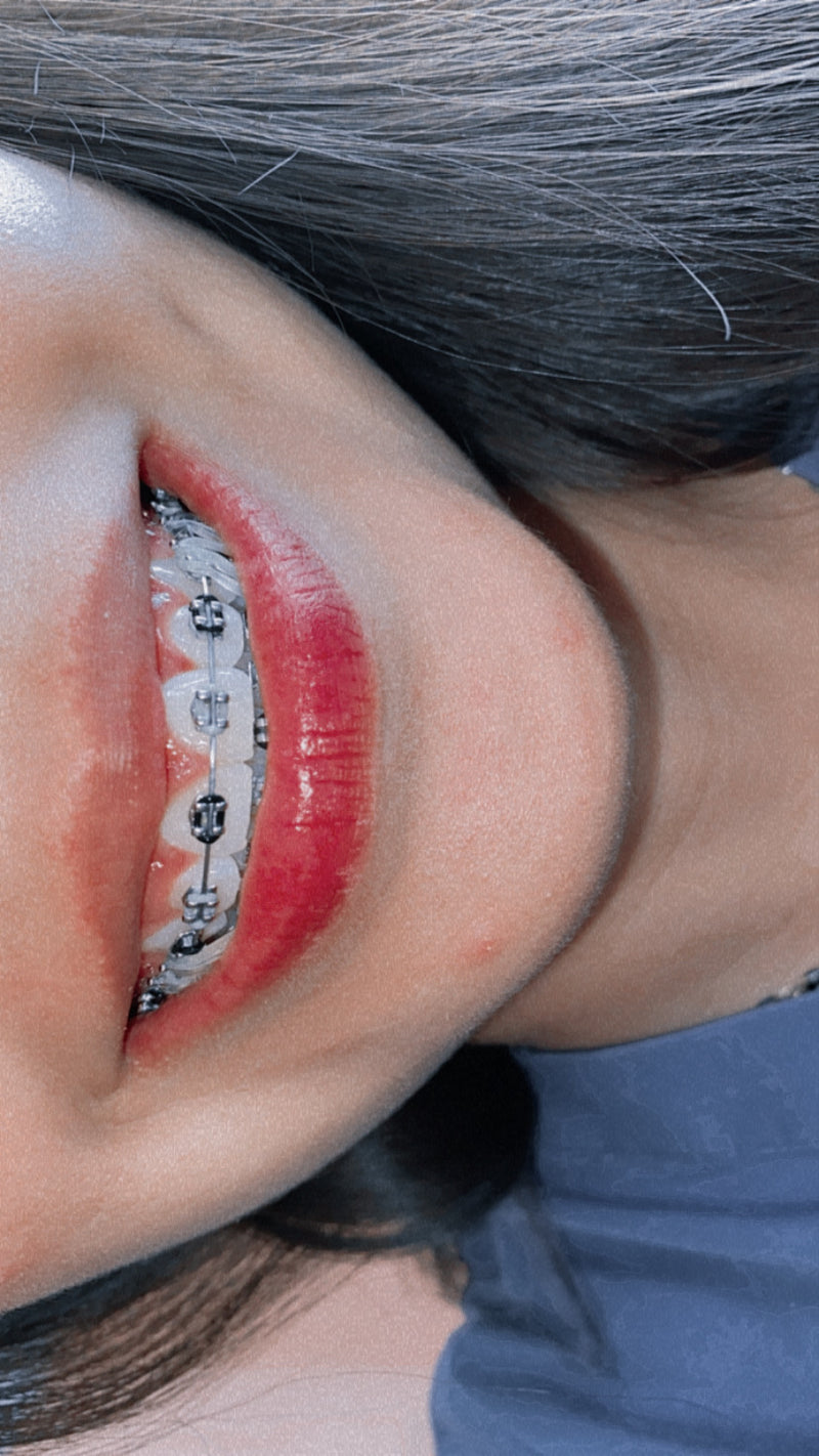 Clinica Dental Bonita Smile